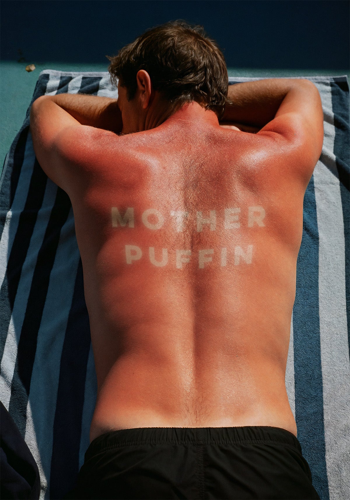 sunburn_mo_puff.jpg